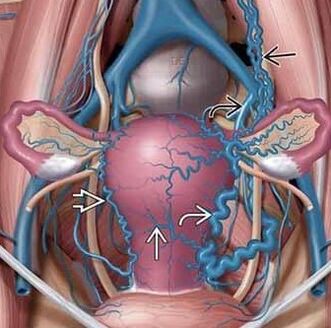 Changing the structure of the vascular walls