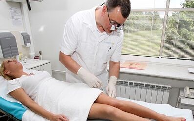 How to treat varicose veins